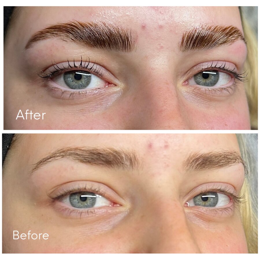 Antes e depois de Brow Lamination