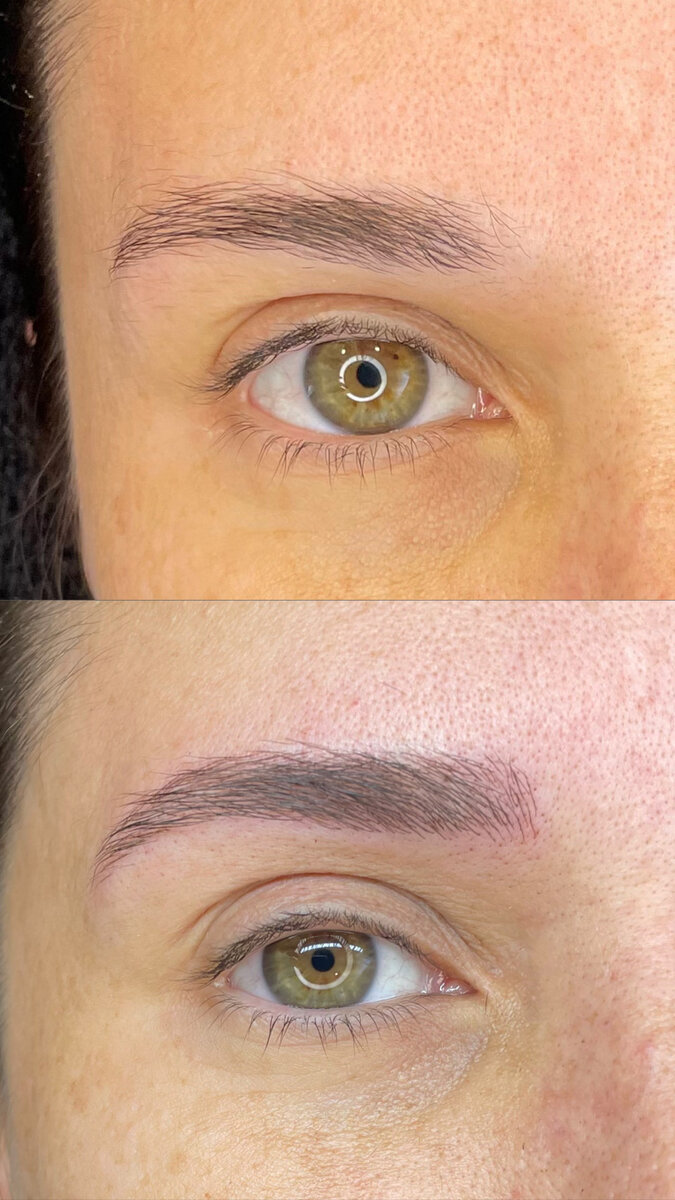 Antes e depois de Design de Sobrancelhas