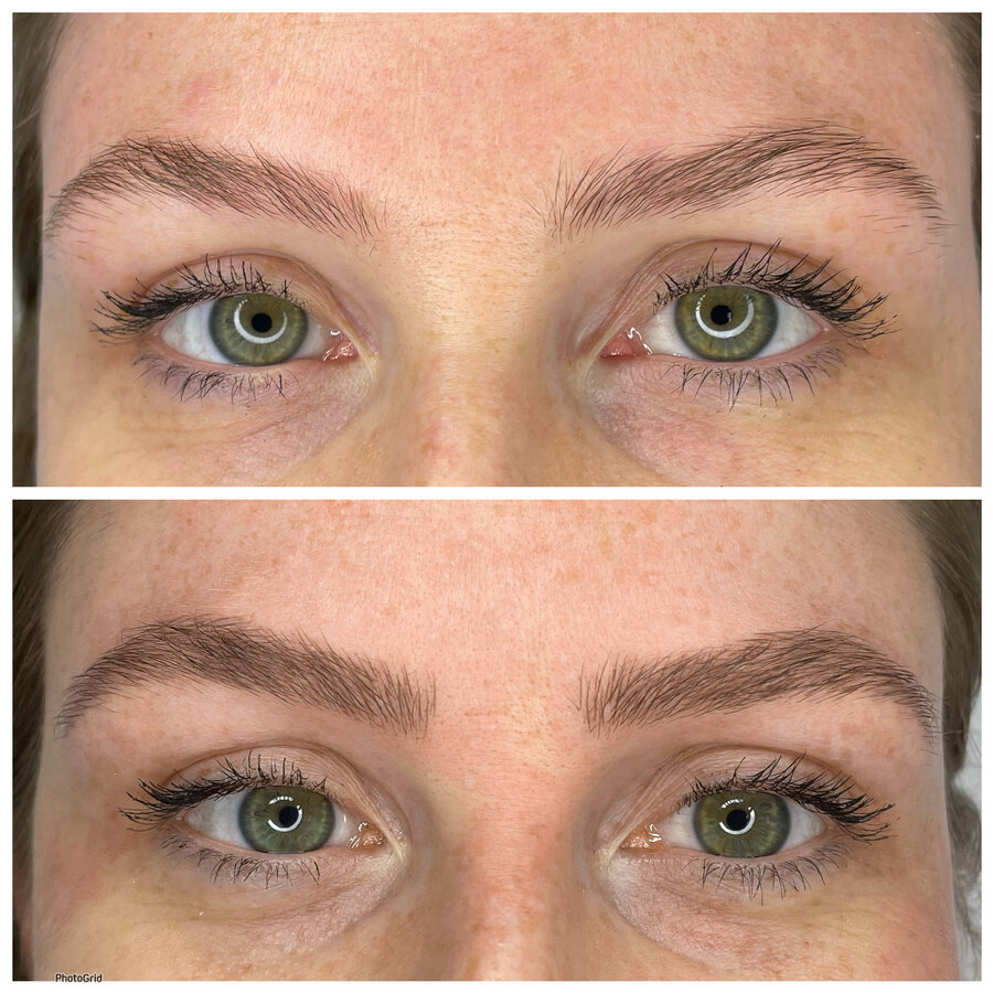 Antes e depois de Nanoblading